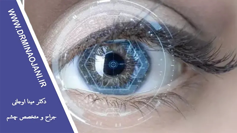 همه‌چیز درباره جراحی لیزیک: از معاینه تا بهبودی