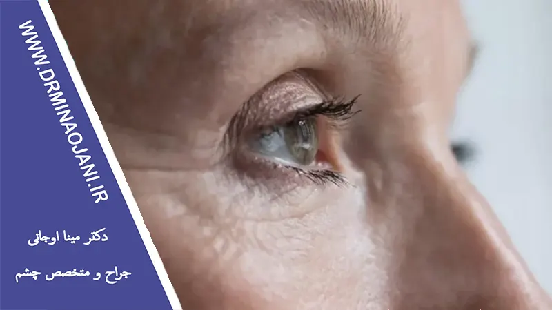 روش‌های نوین برای درمان مشکلات بینایی در سنین بالا