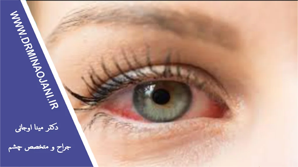 تفاوت خشکی چشم و حساسیت