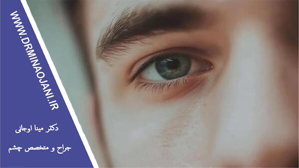 بهترین سن درمان تنبلی چشم